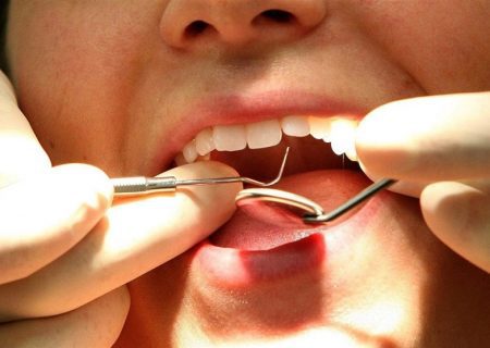 اهمیت دندان سالم
