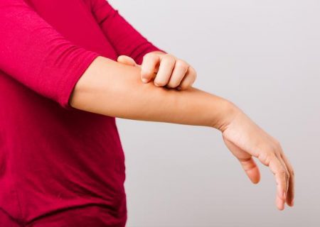 البسه آستین بلند پیشگیری از امراض پوستی