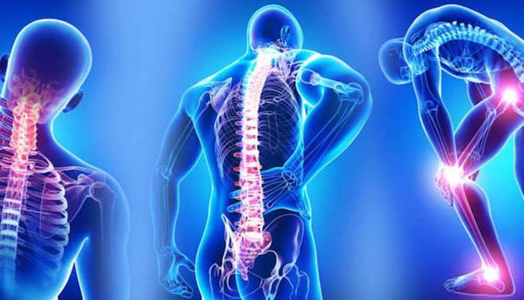 درد مزمن عضلات (فیبرومیالژیا) چیست