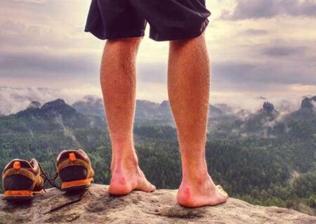 عوارض پوستی پا در ورزش کوهنوردی